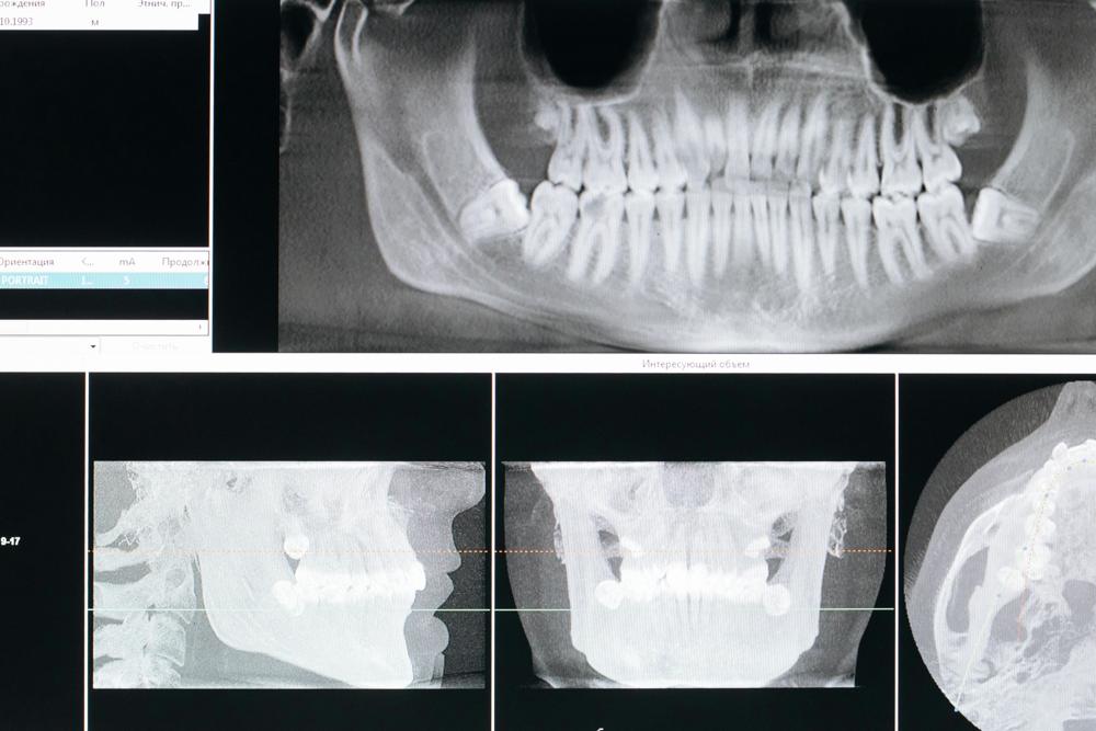 dental examination